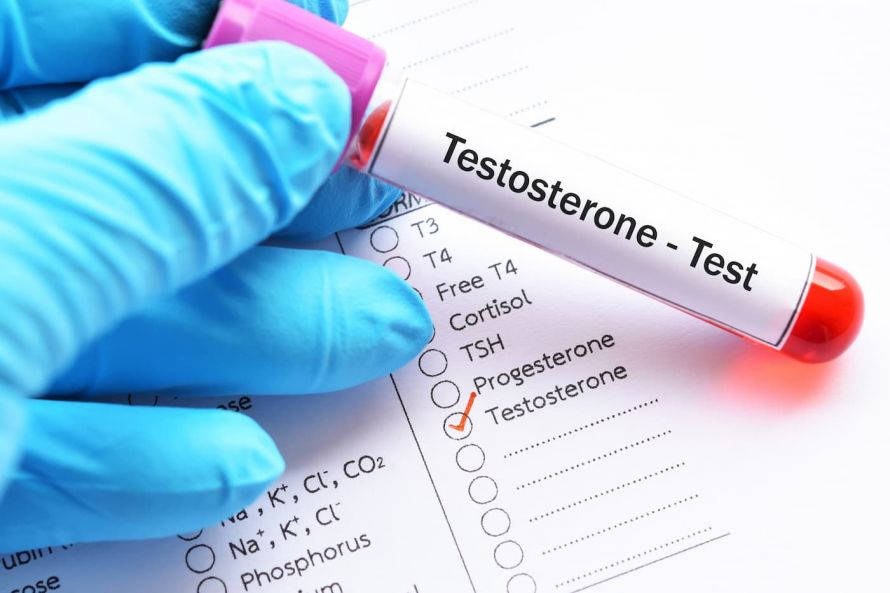 Testosteron-Test