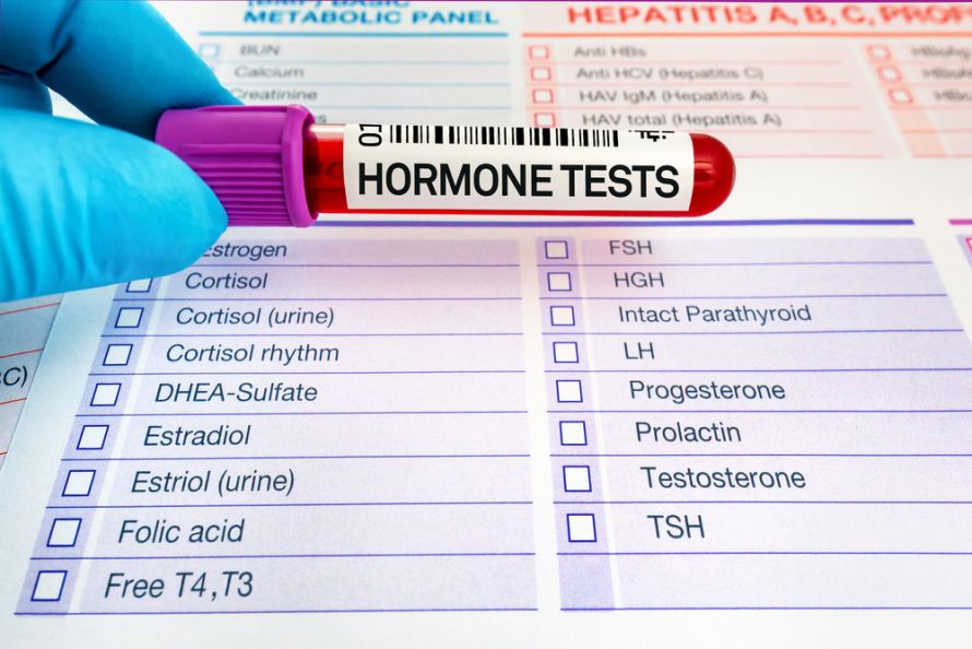 Hormondiagnostik aus Blutabnahme 