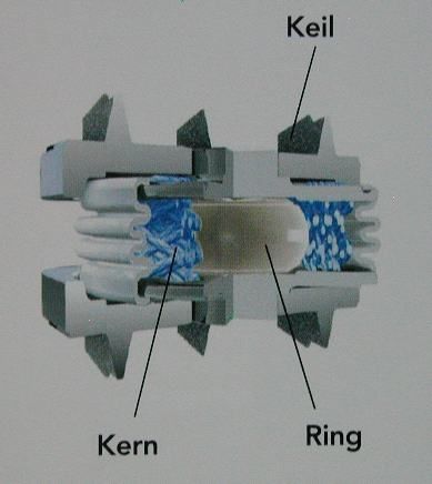 Bandscheibenprothese4